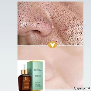 Suero Acido Hialuronico Colageno Poros Obstruidos